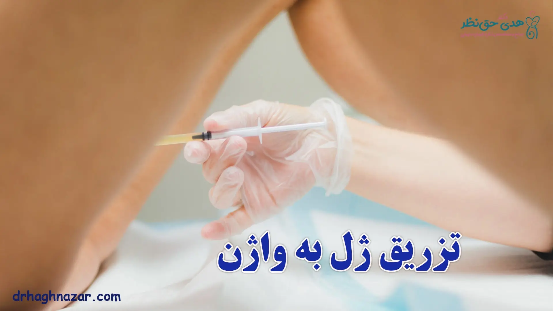 تزریق ژل به واژن