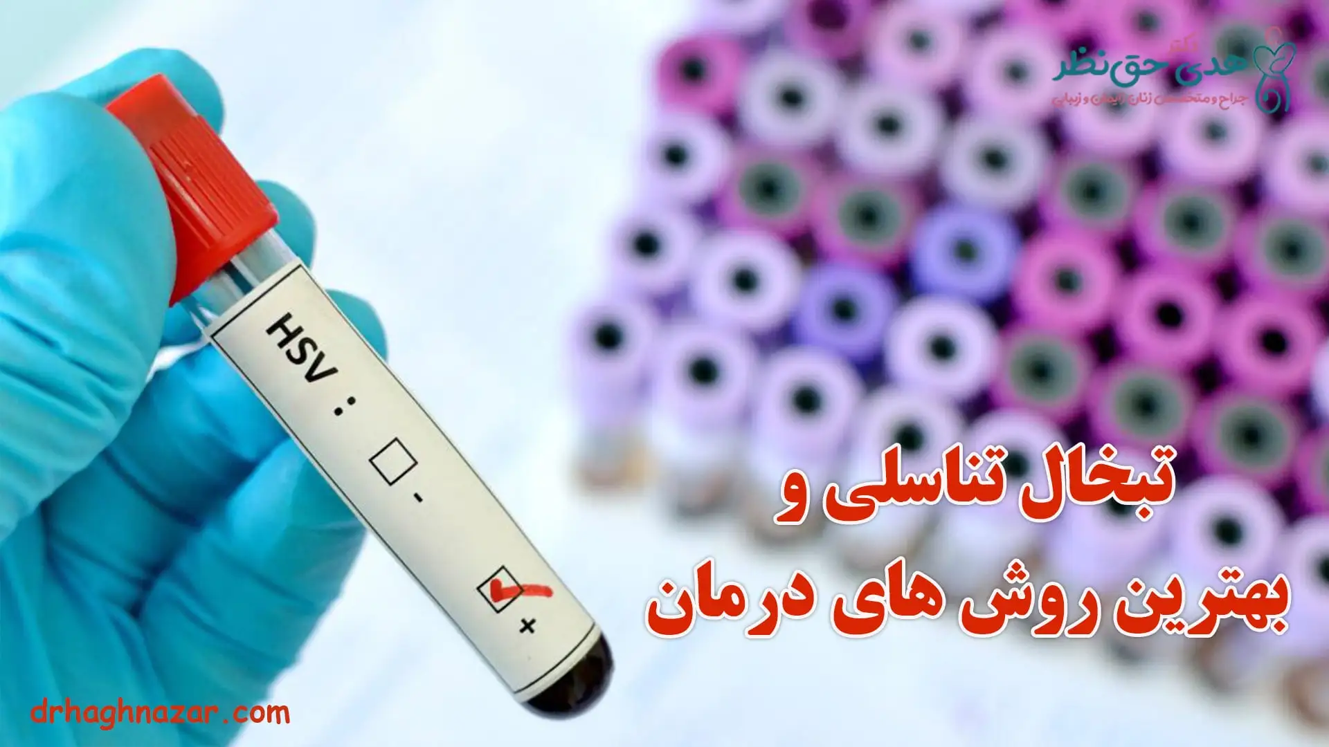 تبخال تناسلی و راه های درمان - علائم تبخال تناسلی