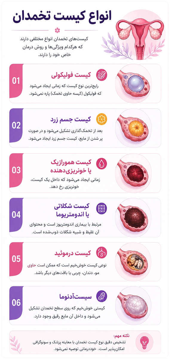 انواع کیست تخمدان