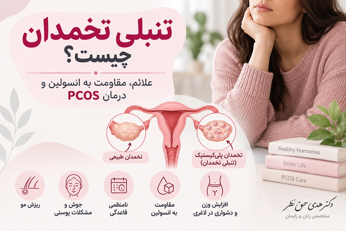 تنبلی تخمدان
