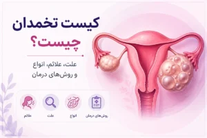 کیست تخمدان