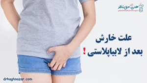 خارش بعد از جراحی ترمیمی لابیا