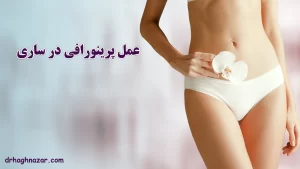 عمل پرینورافی در ساری