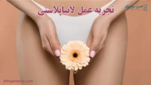 تجربه عمل لابیاپلاستی