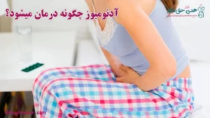 درمان آدنومیوز در ساری