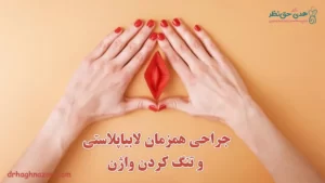 جراحی همزمان لابیاپلاستی و تنگی واژن