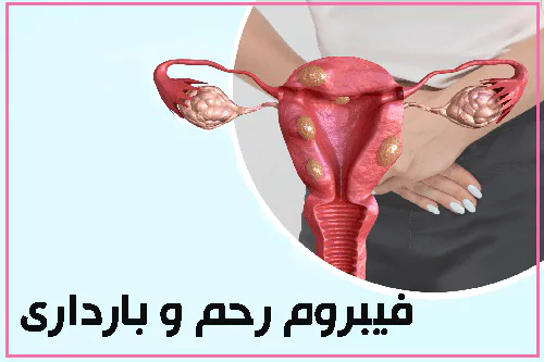 فیبروم رحم و بارداری