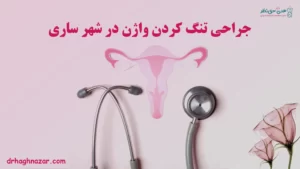 عمل تنگ کردن واژن در ساری