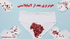 خونریزی بعد از لابیاپلاستی