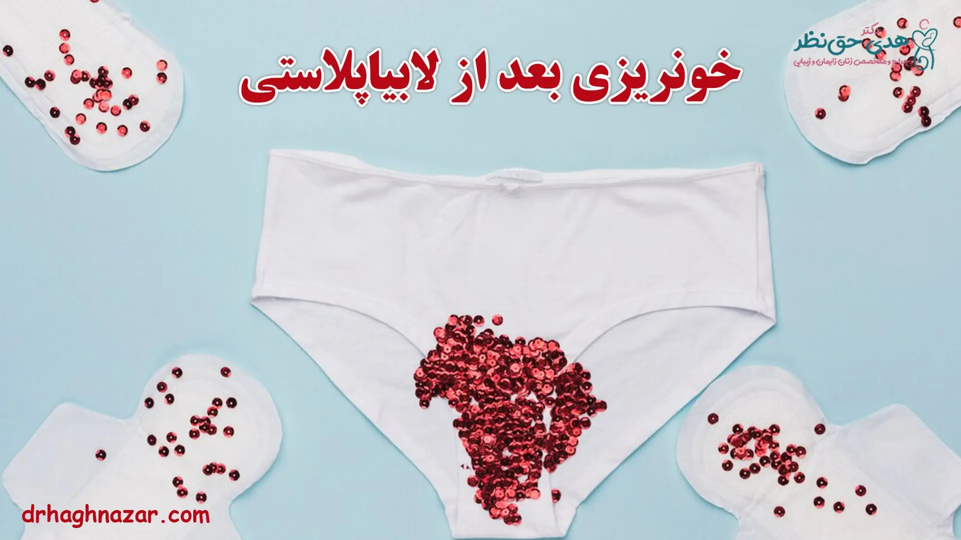 خونریزی بعد از لابیاپلاستی