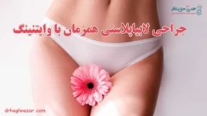 جراحی لابیاپلاستی همزمان با وایتنینگ