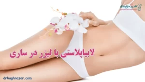 لابیاپلاستی با لیزر در ساری