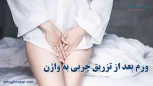 ورم بعد از تزریق چربی به واژن