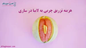 هزینه تزریق چربی به واژن (لابیا ماژور) در ساری