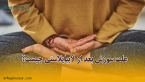 علت سوزش بعد از عمل لابیاپلاستی