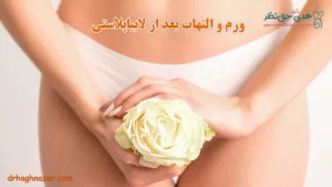 ورم بعد از لابیاپلاستی