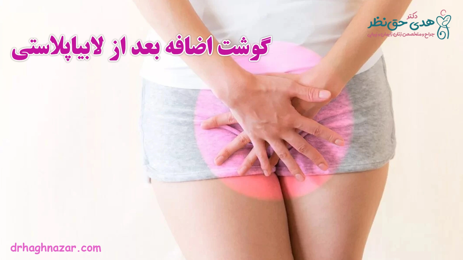 گوشت اضافه بعد از لابیاپلاستی