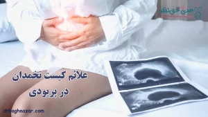 علائم کیست تخمدان در پریودی