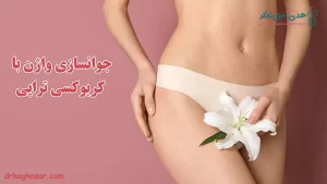 جوانسازی واژن با کربوکسی تراپی