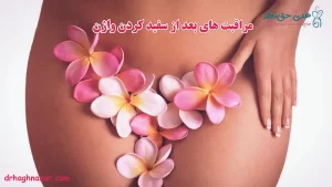 مراقبت های بعد از سفید کردن واژن