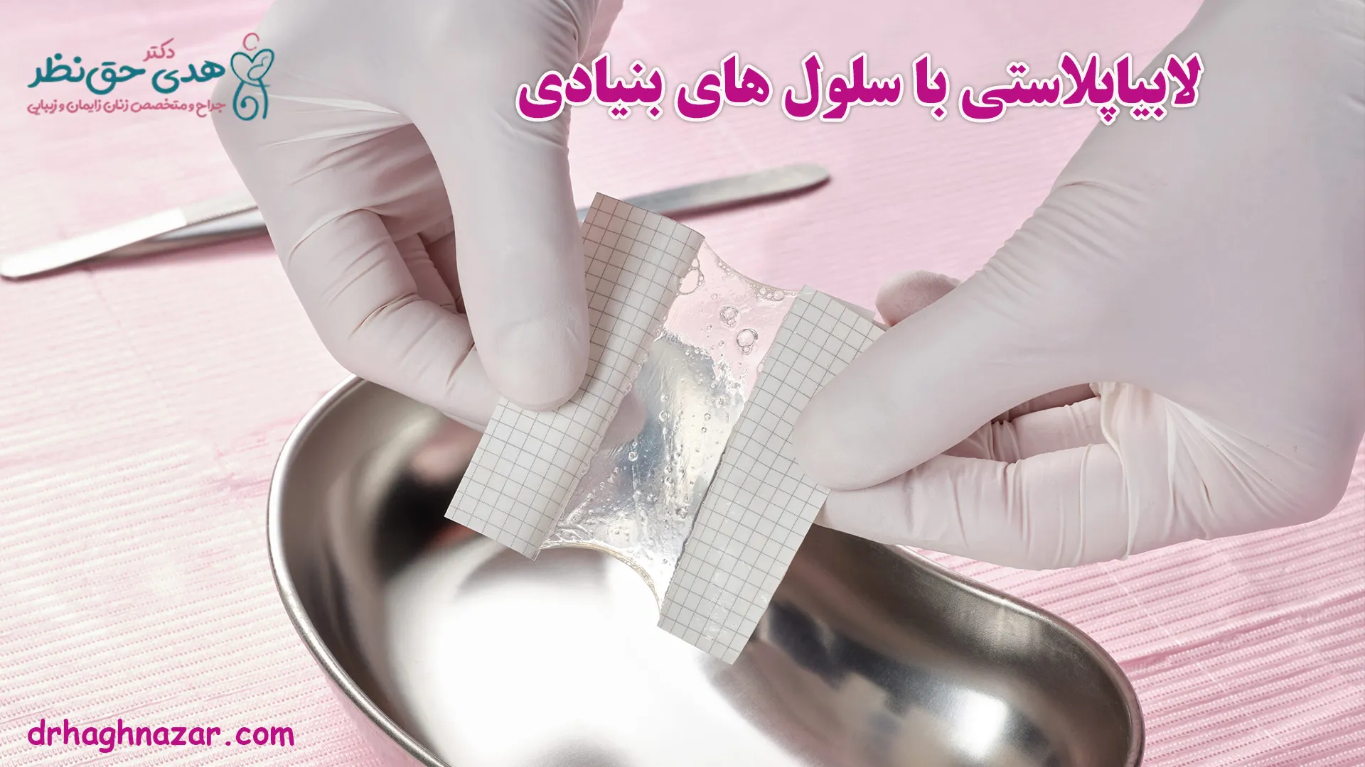 لابیاپلاستی با سلول های بنیادی