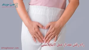 راه رفتن بعد از عمل لابیاپلاستی