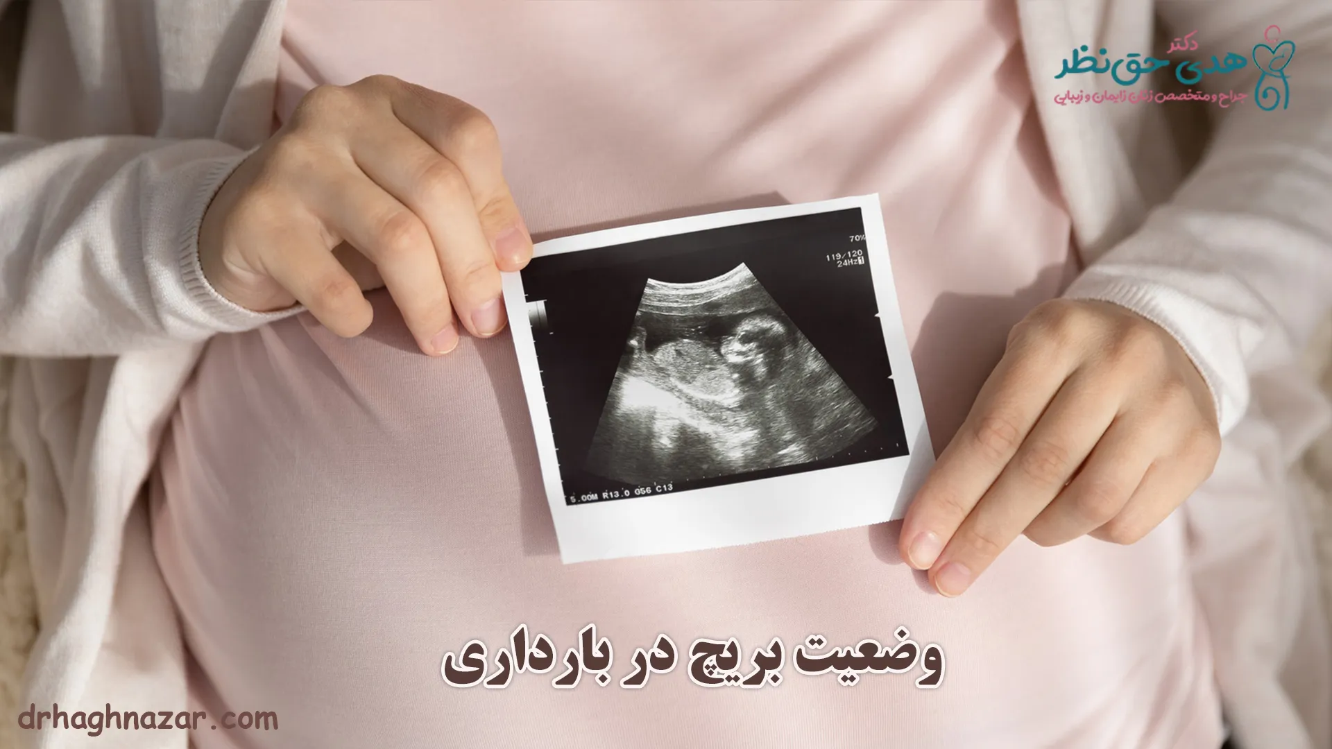 وضعیت بریچ در بارداری