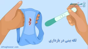 لکه‌ بینی در بارداری