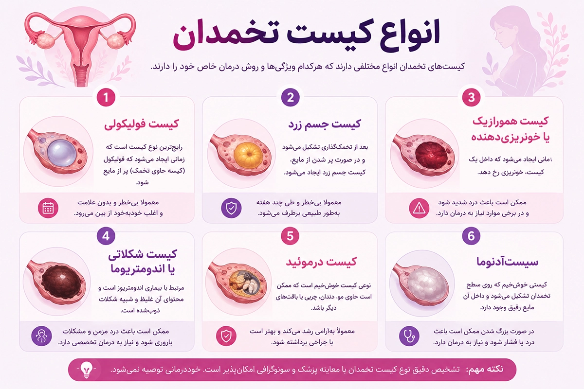 انواع کیست تخمدان